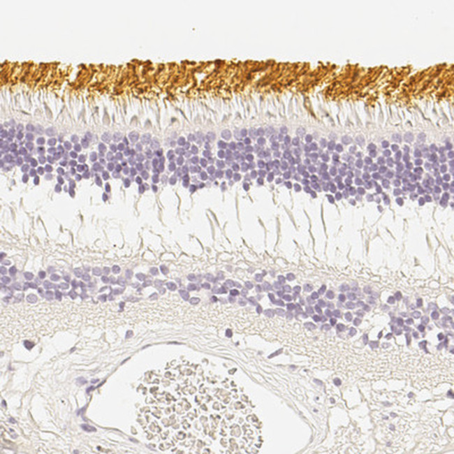 Opsin Blue Antibody in Immunohistochemistry (IHC)