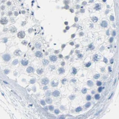 Opsin Blue Antibody in Immunohistochemistry (IHC)