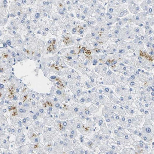 Opsin Blue Antibody in Immunohistochemistry (IHC)