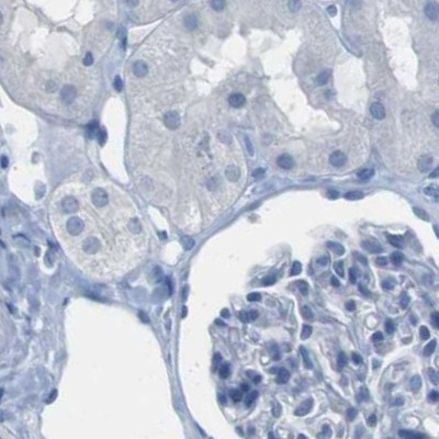 Opsin Blue Antibody in Immunohistochemistry (IHC)