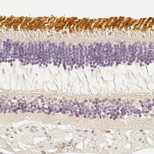 Opsin Blue Antibody in Immunohistochemistry (IHC)