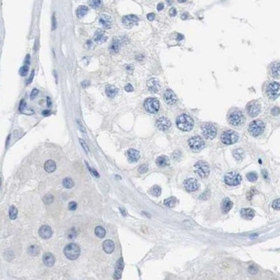 Opsin Blue Antibody in Immunohistochemistry (IHC)