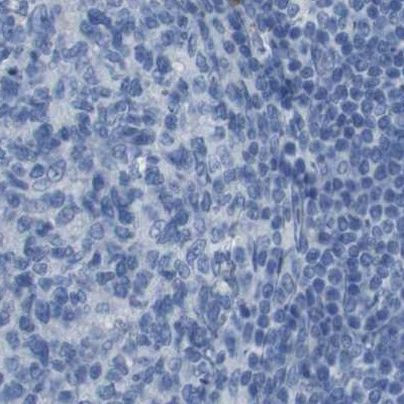 Opsin Blue Antibody in Immunohistochemistry (IHC)