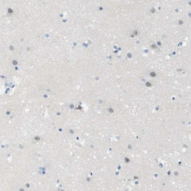 Opsin Blue Antibody in Immunohistochemistry (IHC)