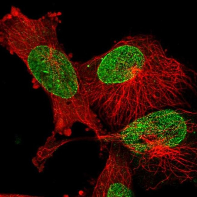 Epigen Antibody in Immunocytochemistry (ICC/IF)