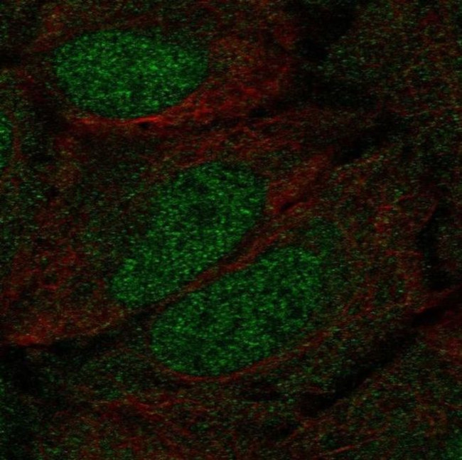 DCLK1 Antibody in Immunocytochemistry (ICC/IF)