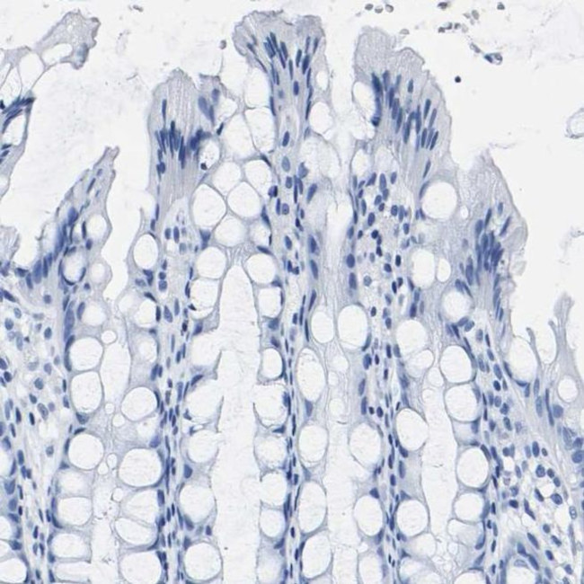 IMPG2 Antibody in Immunohistochemistry (IHC)