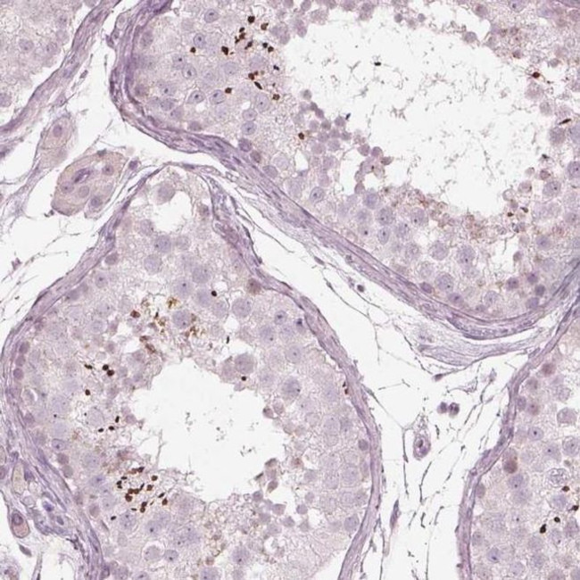 KRTAP24-1 Antibody in Immunohistochemistry (IHC)