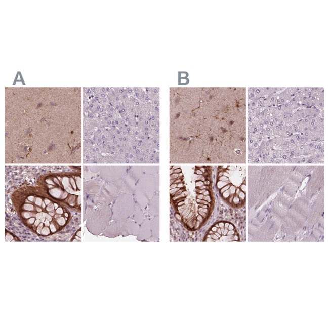 Sorcin Antibody in Immunohistochemistry (IHC)