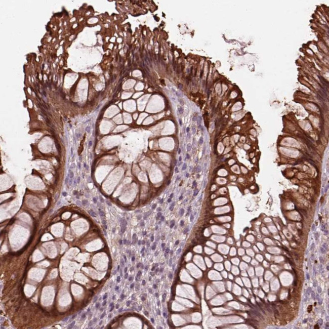 Sorcin Antibody in Immunohistochemistry (IHC)