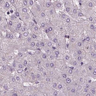 Sorcin Antibody in Immunohistochemistry (IHC)