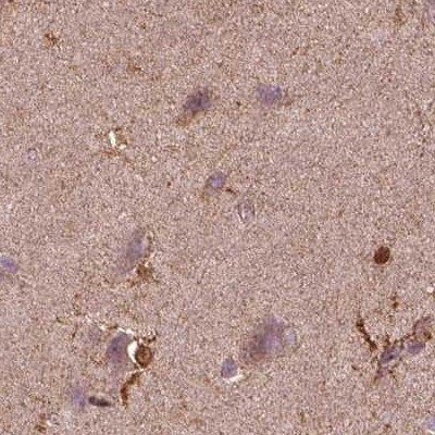 Sorcin Antibody in Immunohistochemistry (IHC)