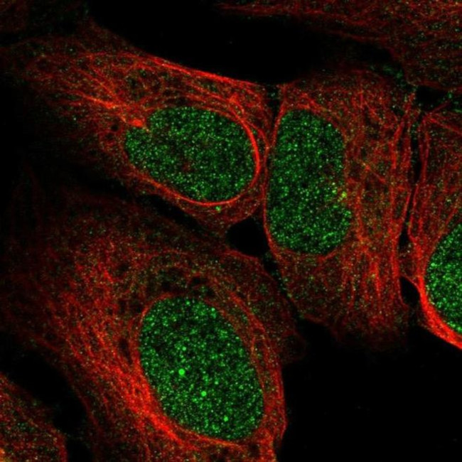 RRP4 Antibody in Immunocytochemistry (ICC/IF)