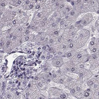 RP1L1 Antibody in Immunohistochemistry (IHC)