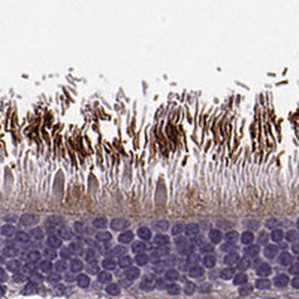 RP1L1 Antibody in Immunohistochemistry (IHC)