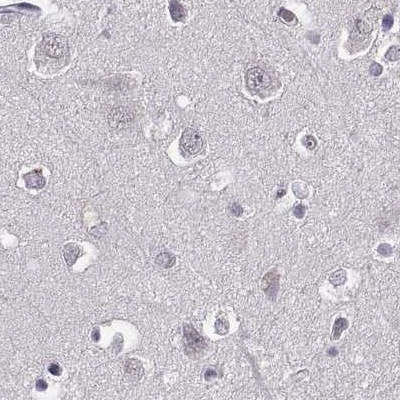 RP1L1 Antibody in Immunohistochemistry (IHC)