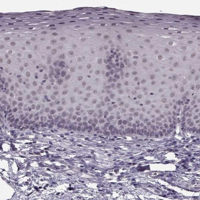 RP1L1 Antibody in Immunohistochemistry (IHC)