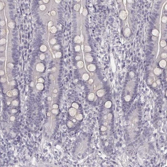 Cytokeratin 26 Antibody in Immunohistochemistry (IHC)