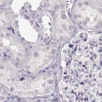 IMPG1 Antibody in Immunohistochemistry (IHC)