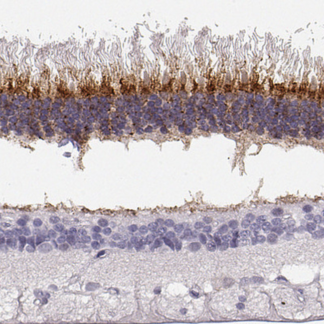 IMPG1 Antibody in Immunohistochemistry (IHC)