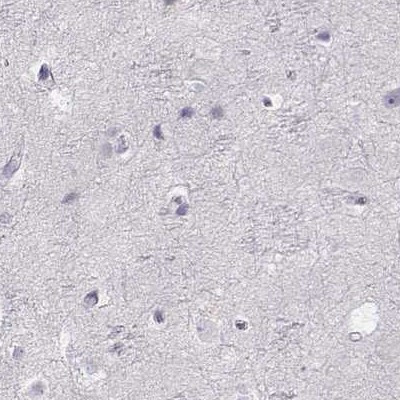 IMPG1 Antibody in Immunohistochemistry (IHC)