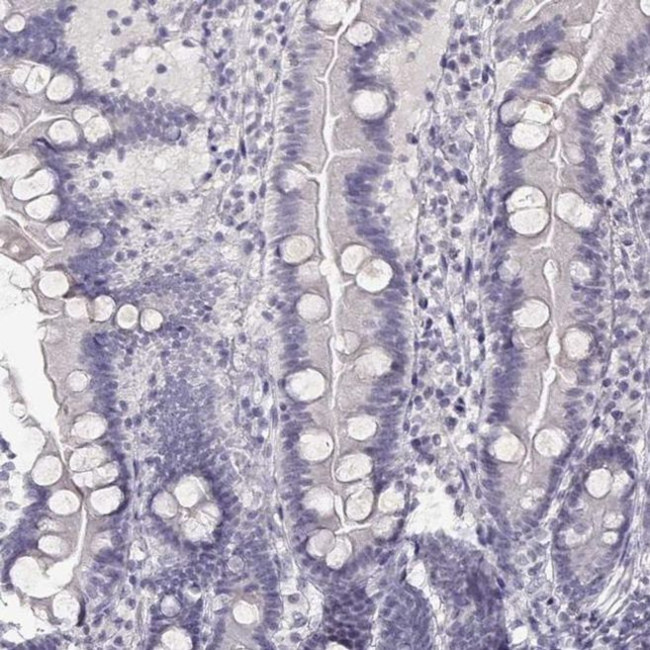 IMPG1 Antibody in Immunohistochemistry (IHC)