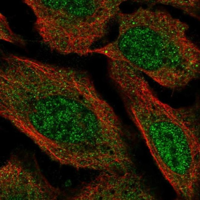 VPS13D Antibody in Immunocytochemistry (ICC/IF)