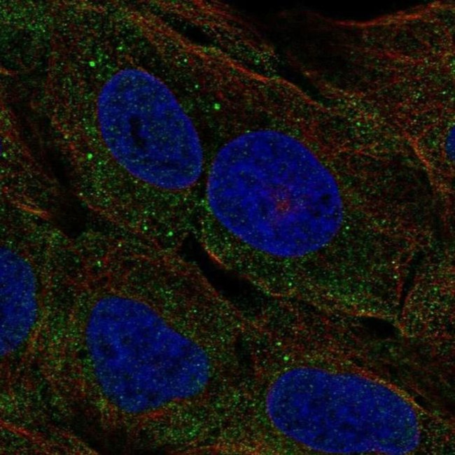 ELA3A Antibody in Immunocytochemistry (ICC/IF)