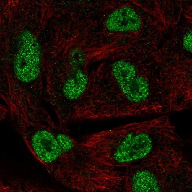 HORMAD1 Antibody in Immunocytochemistry (ICC/IF)