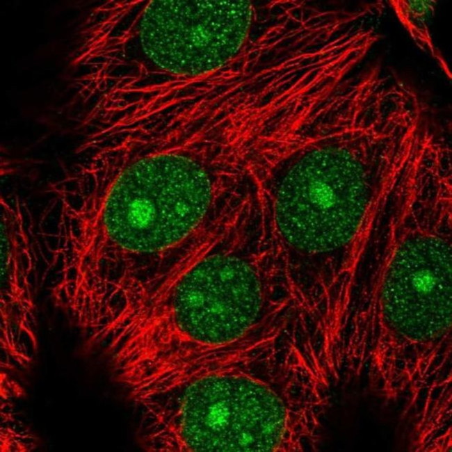 MAD2L1BP Antibody in Immunocytochemistry (ICC/IF)