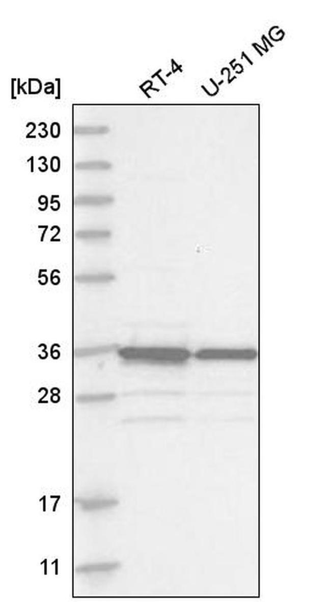 MAD2L1BP Antibody in Western Blot (WB)