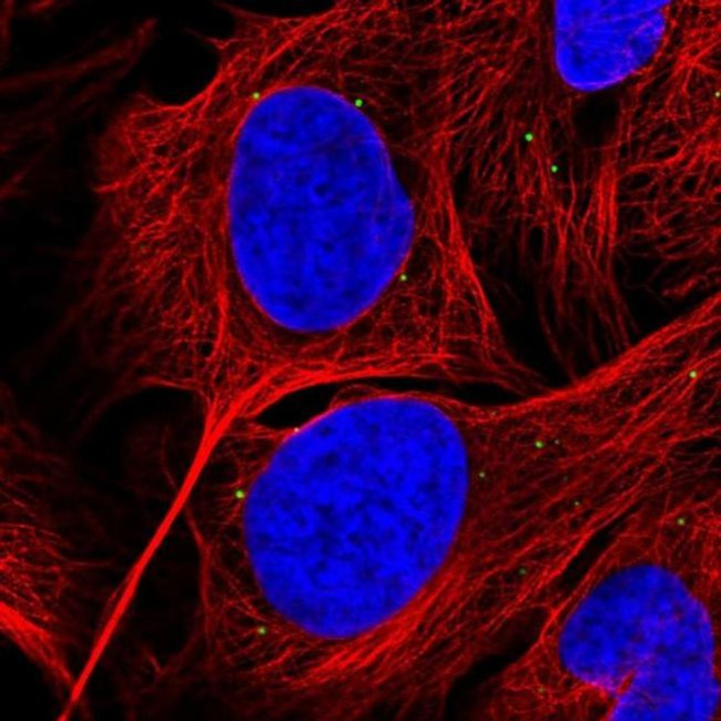 GRK4 Antibody in Immunocytochemistry (ICC/IF)