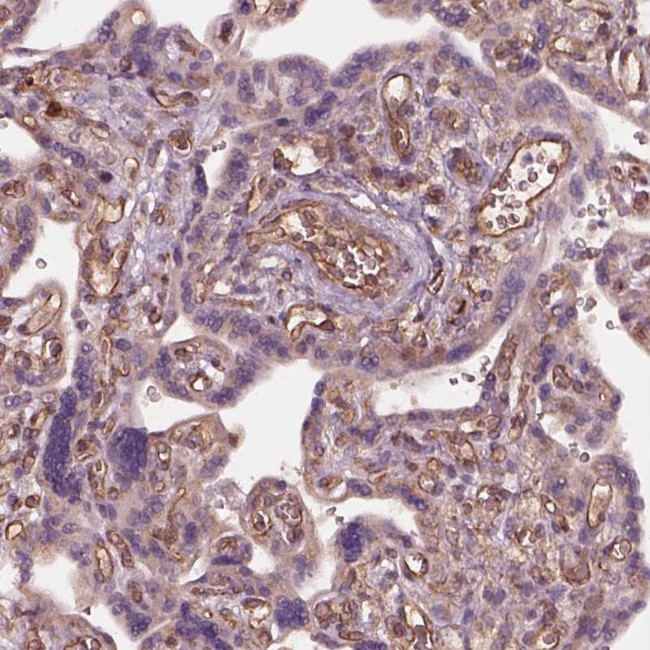 HTR1B Antibody in Immunohistochemistry (IHC)