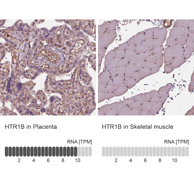 HTR1B Antibody