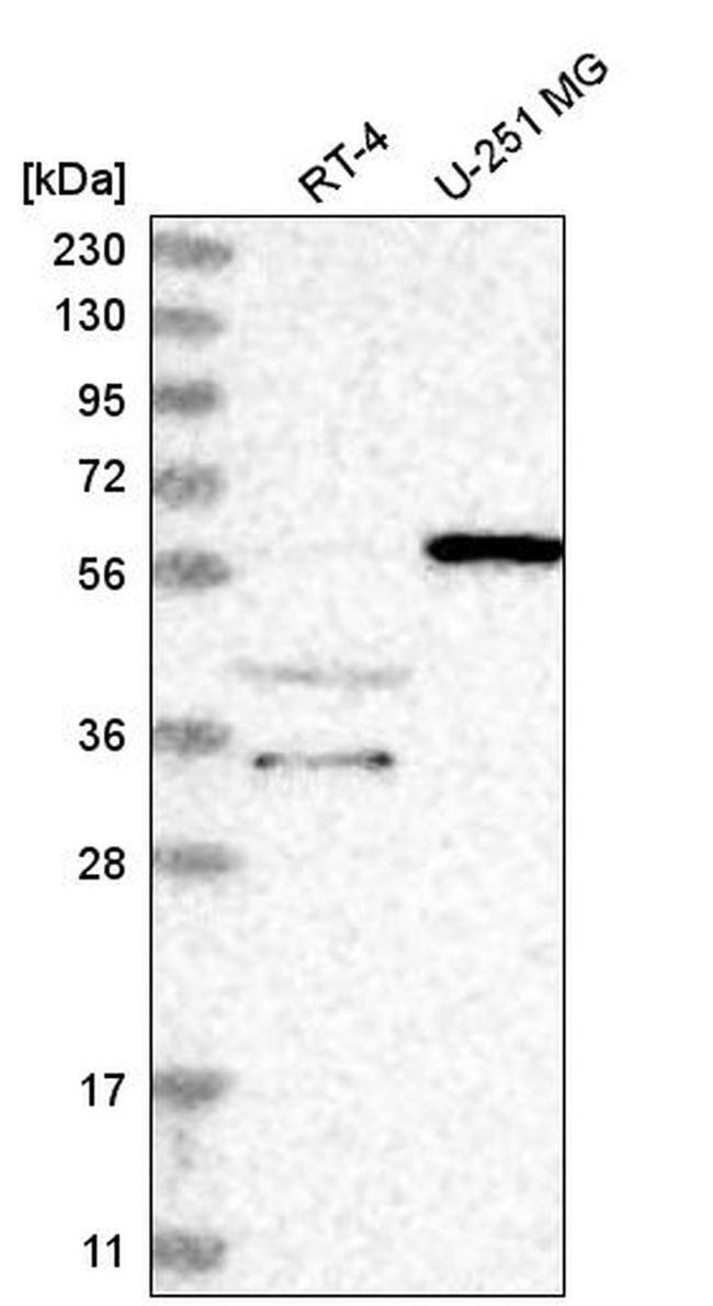 NRBP2 Antibody in Western Blot (WB)