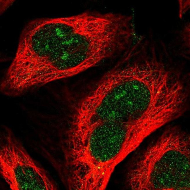 RRP36 Antibody in Immunocytochemistry (ICC/IF)