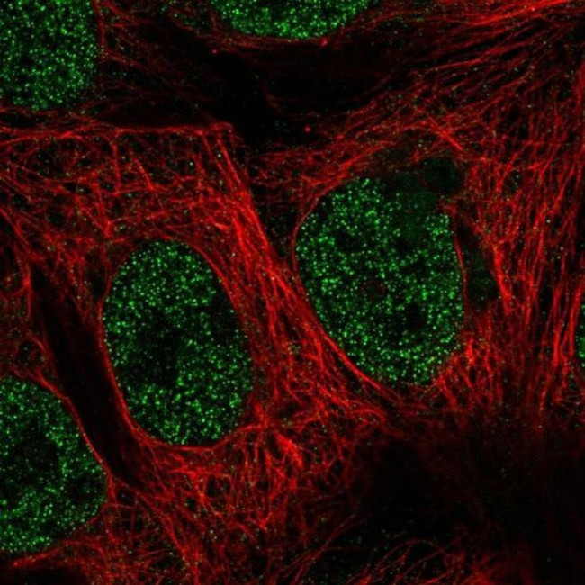 C21orf7 Antibody in Immunocytochemistry (ICC/IF)