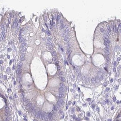 IMPG1 Antibody in Immunohistochemistry (IHC)