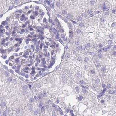 IMPG1 Antibody in Immunohistochemistry (IHC)