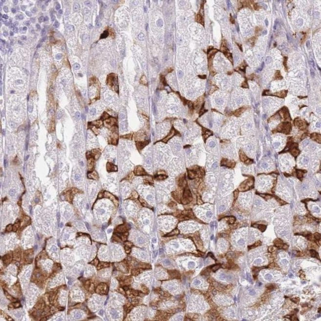 IMPG1 Antibody in Immunohistochemistry (IHC)