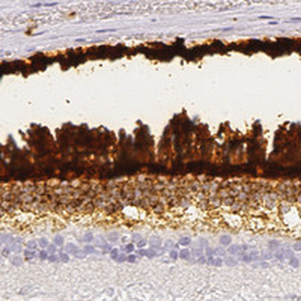 IMPG1 Antibody in Immunohistochemistry (IHC)