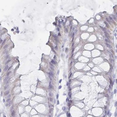 IMPG1 Antibody in Immunohistochemistry (IHC)