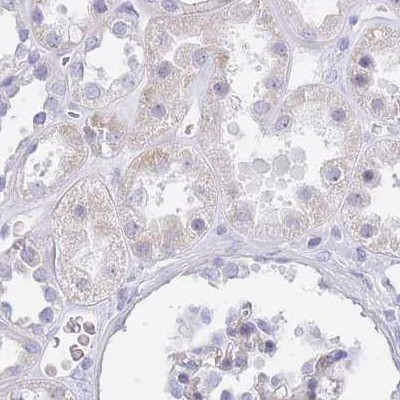 IMPG1 Antibody in Immunohistochemistry (IHC)