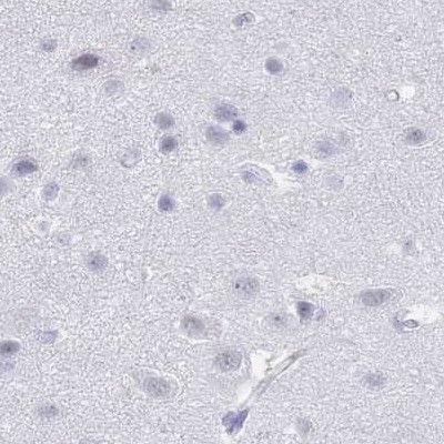 IMPG1 Antibody in Immunohistochemistry (IHC)