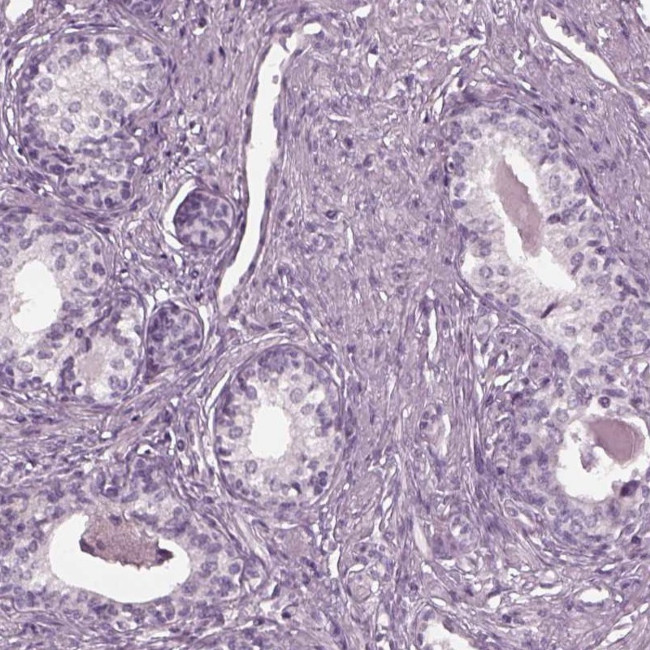 YY2 Antibody in Immunohistochemistry (IHC)