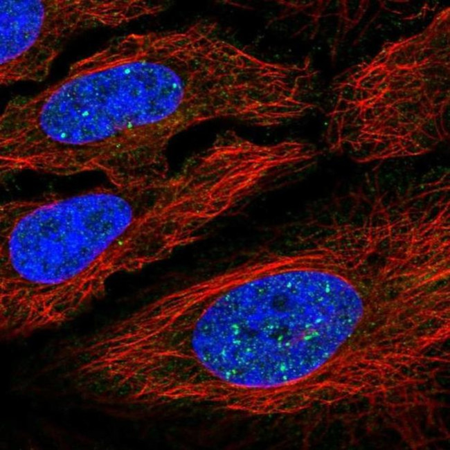 YY2 Antibody in Immunocytochemistry (ICC/IF)