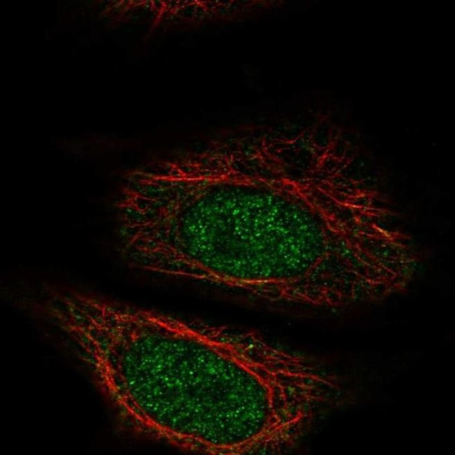 ZYG11A Antibody in Immunocytochemistry (ICC/IF)