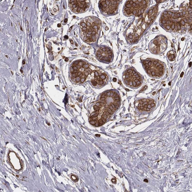 PALMD Antibody in Immunohistochemistry (IHC)