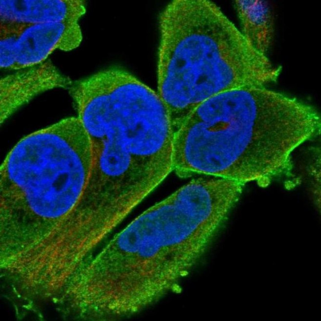 PALMD Antibody in Immunocytochemistry (ICC/IF)