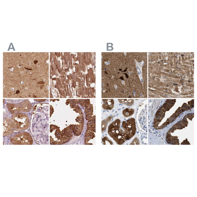 CRYM Antibody in Immunohistochemistry (IHC)